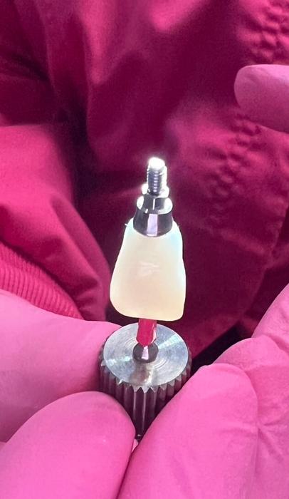 dental implant sweetwater | dentist holding implant with crown