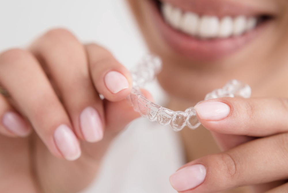 clear aligners sweetwater | woman holding aligner