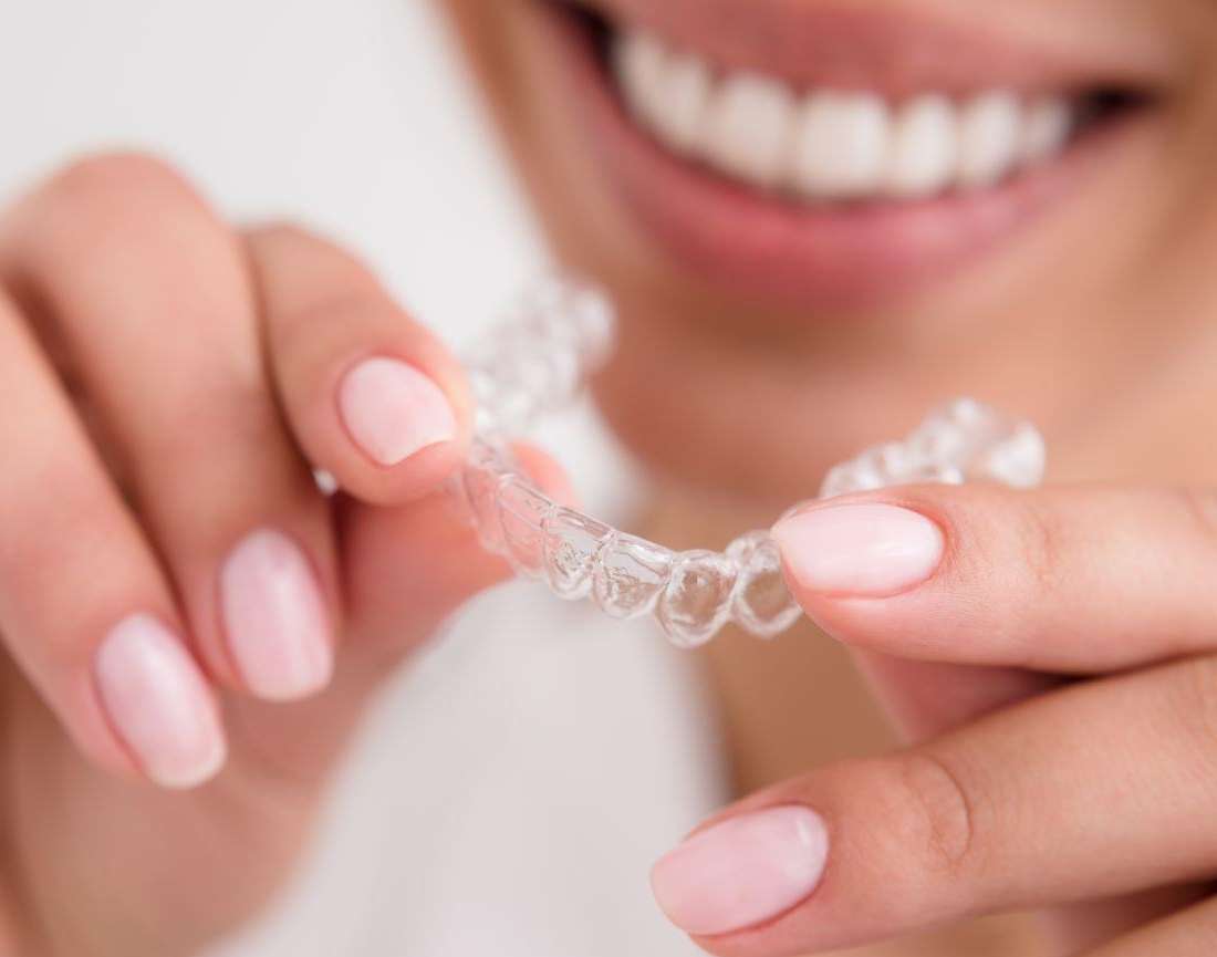 Clear Aligners for Adults Sweetwater | Am I a Good Candidate?