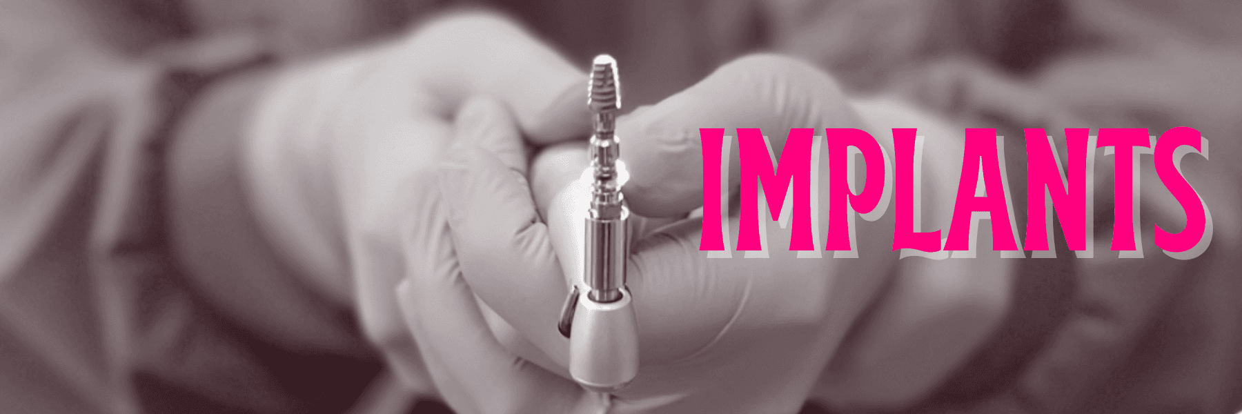 dental implants sweetwater