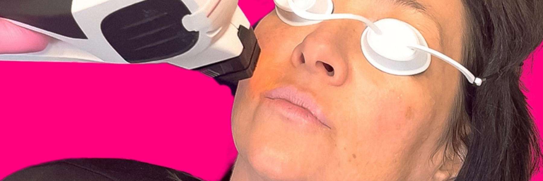 laser treatments sweetwater