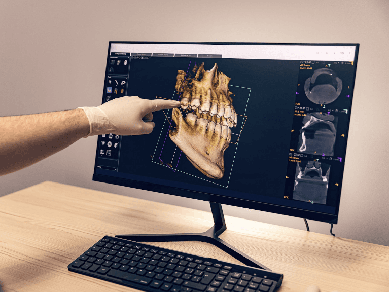 general dentist sweetwater | dentist using CBCT cone beam technology