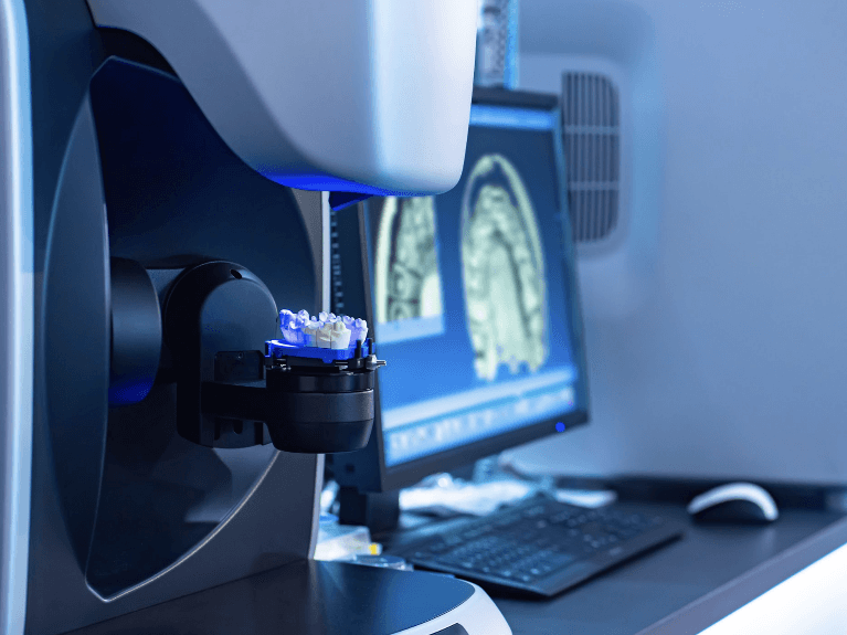 same-day crowns sweetwater | CEREC technology
