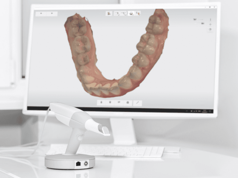 cosmetic dentist sweetwater | digital impressions