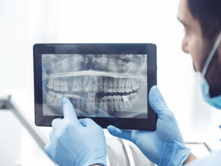 general dentist sweetwater | digital x-rays