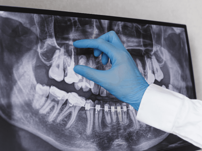 general dentist sweetwater | dentist looking at dental x-ray